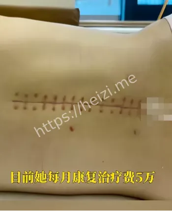 道德争议