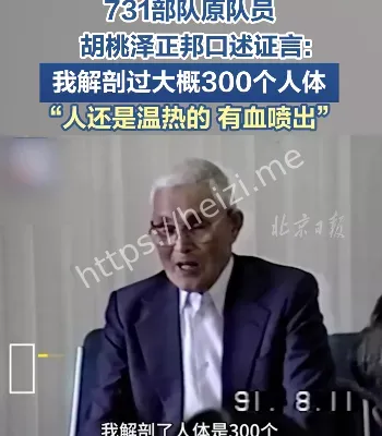 人体解剖