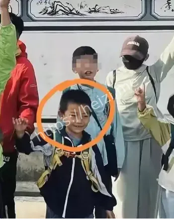 黄金救援