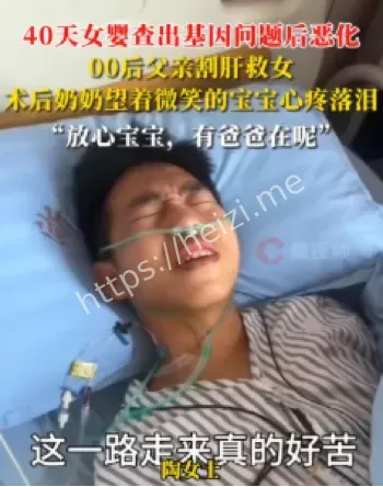 肝功能衰竭