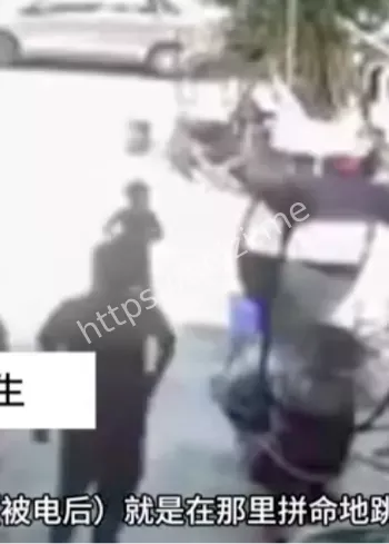 点火器致伤