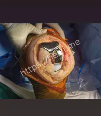 血腥现场