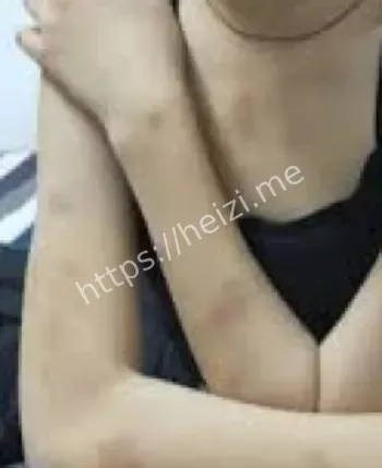 兴安医学院学妹围殴传言