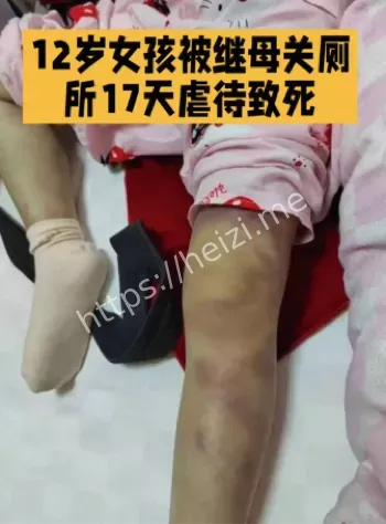 虐童案件