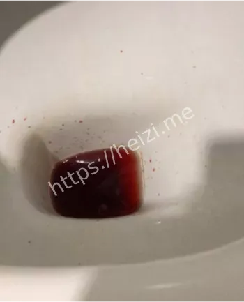 上海男子自慰致死案例