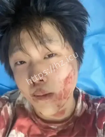 赵俊逸车库群殴